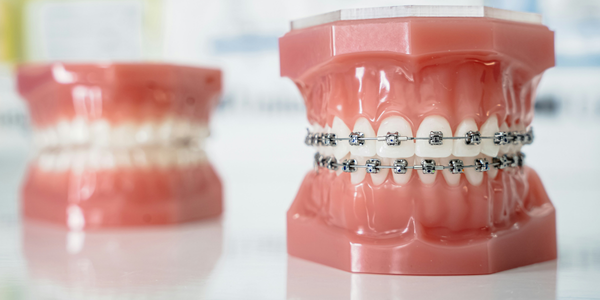 Orthodontics